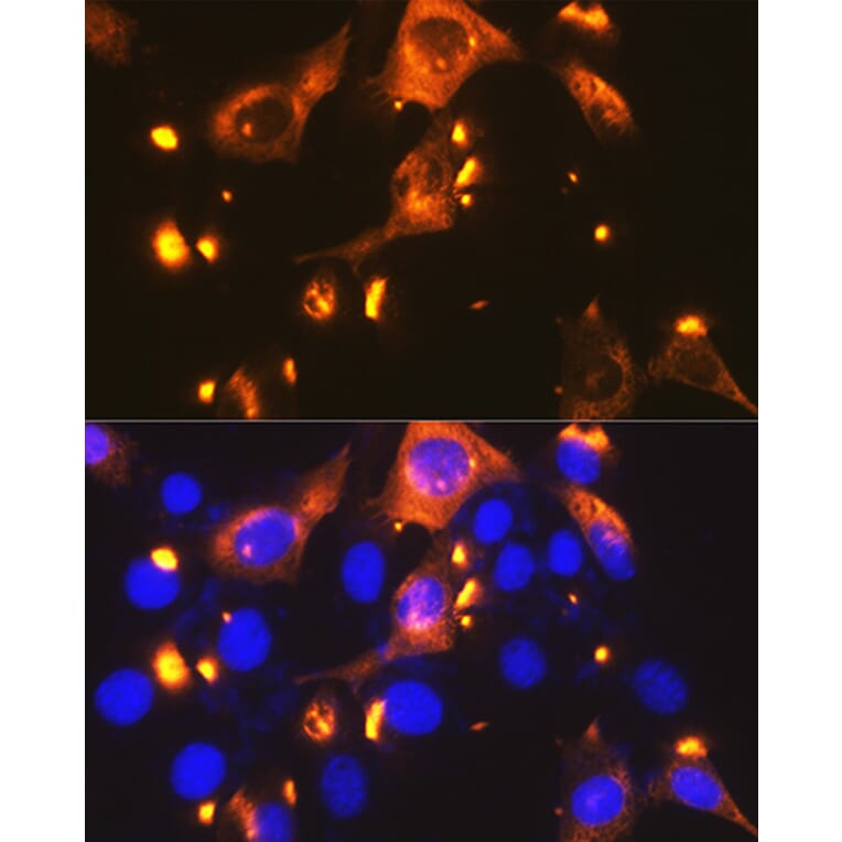 Immunofluorescence - Anti-Glucose Transporter GLUT2 Antibody [ARC0305] (A307905) - Antibodies.com