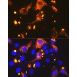Immunofluorescence - Anti-Glucose Transporter GLUT2 Antibody [ARC0305] (A307905) - Antibodies.com