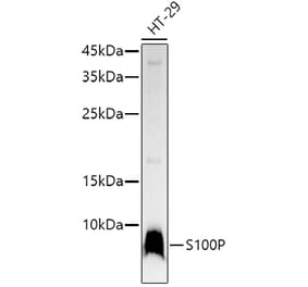 Western Blot - Anti-S100P Antibody [ARC50711] (A307906) - Antibodies.com