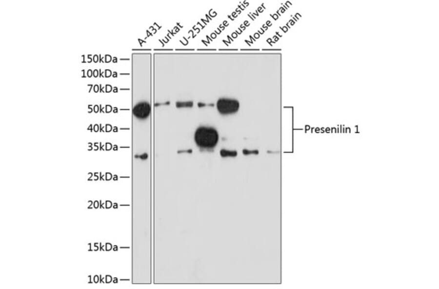Western Blot - Anti-Presenilin 1/PS-1 Antibody [ARC0440] (A307907) - Antibodies.com