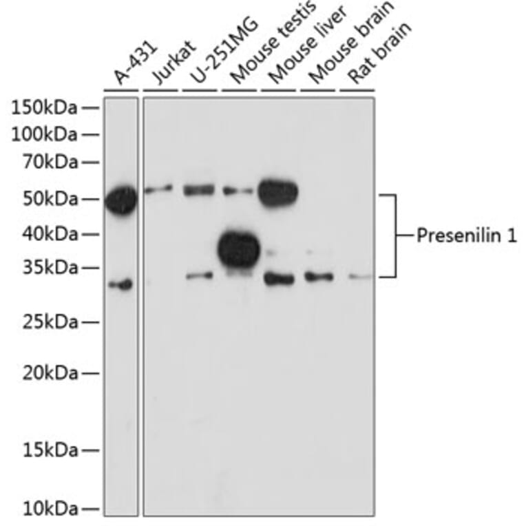 Western Blot - Anti-Presenilin 1/PS-1 Antibody [ARC0440] (A307907) - Antibodies.com