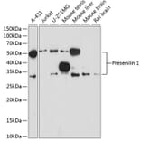 Western Blot - Anti-Presenilin 1/PS-1 Antibody [ARC0440] (A307907) - Antibodies.com