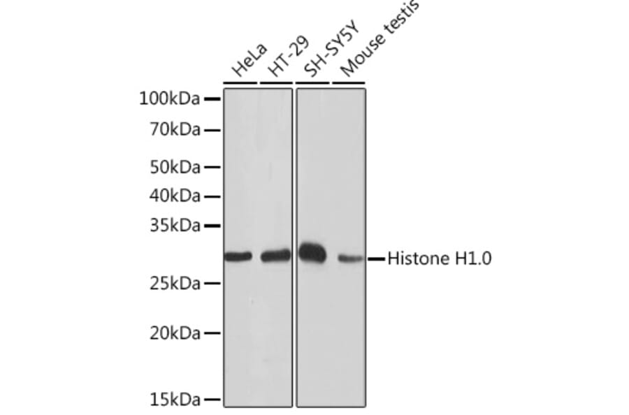 Western Blot - Anti-Histone H1.0 Antibody [ARC1059] (A307908) - Antibodies.com