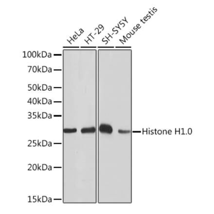 Western Blot - Anti-Histone H1.0 Antibody [ARC1059] (A307908) - Antibodies.com