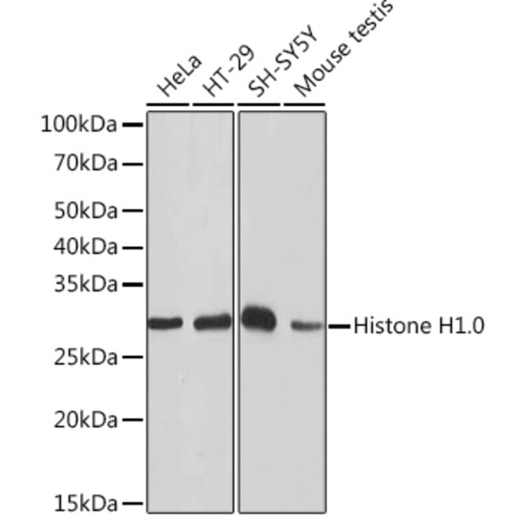 Western Blot - Anti-Histone H1.0 Antibody [ARC1059] (A307908) - Antibodies.com