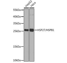 Western Blot - Anti-Hsp27 Antibody (A307909) - Antibodies.com