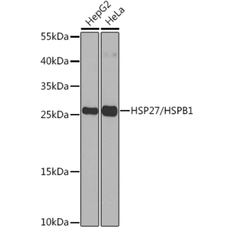 Western Blot - Anti-Hsp27 Antibody (A307909) - Antibodies.com