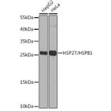 Western Blot - Anti-Hsp27 Antibody (A307909) - Antibodies.com