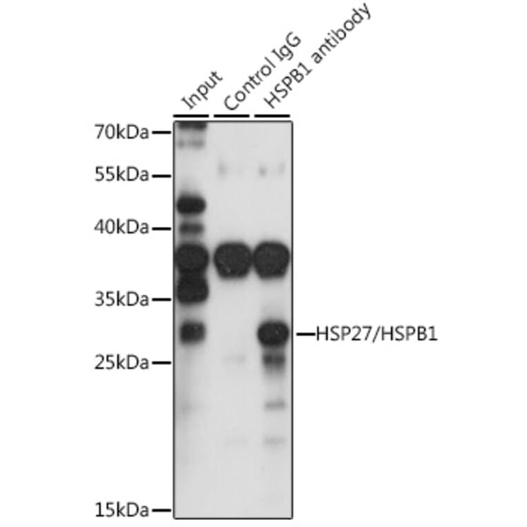 Western Blot - Anti-Hsp27 Antibody (A307909) - Antibodies.com