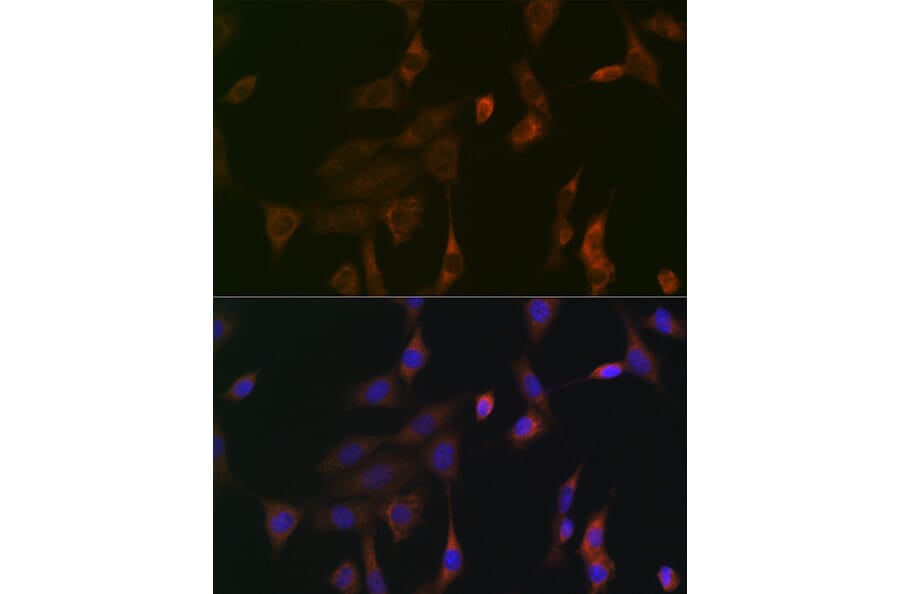 Immunofluorescence - Anti-NRAS + GTPase HRAS + KRAS Antibody (A307913) - Antibodies.com