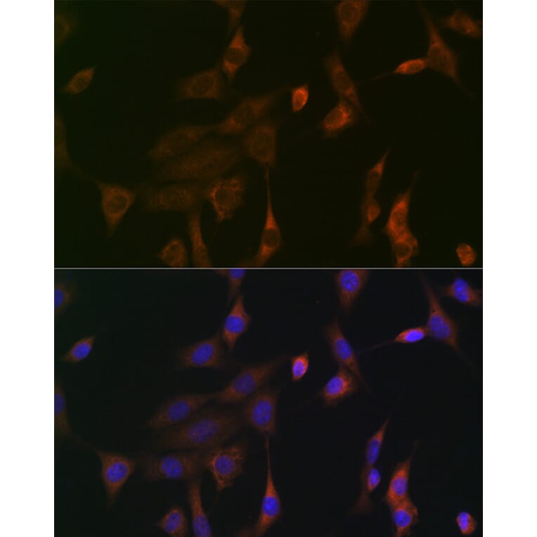 Immunofluorescence - Anti-NRAS + GTPase HRAS + KRAS Antibody (A307913) - Antibodies.com