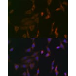 Immunofluorescence - Anti-NRAS + GTPase HRAS + KRAS Antibody (A307913) - Antibodies.com