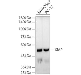 Western Blot - Anti-XIAP Antibody [ARC51953] (A307914) - Antibodies.com