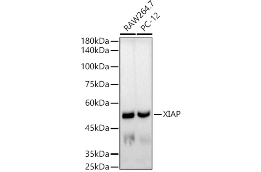 Western Blot - Anti-XIAP Antibody [ARC51953] (A307914) - Antibodies.com