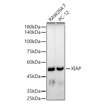 Western Blot - Anti-XIAP Antibody [ARC51953] (A307914) - Antibodies.com