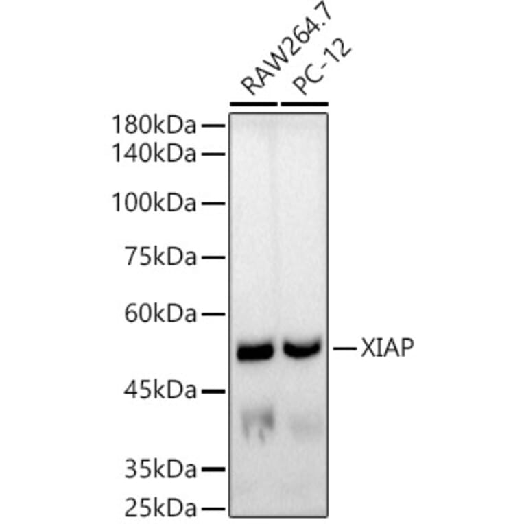 Western Blot - Anti-XIAP Antibody [ARC51953] (A307914) - Antibodies.com