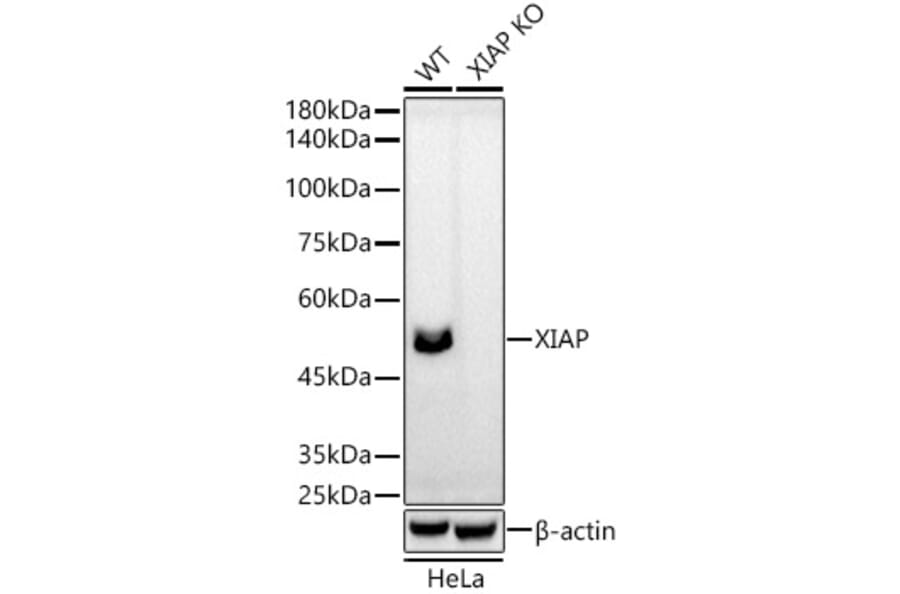 Western Blot - Anti-XIAP Antibody [ARC51953] (A307914) - Antibodies.com