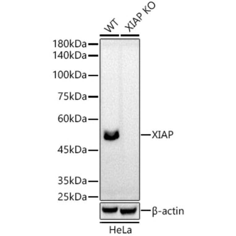 Western Blot - Anti-XIAP Antibody [ARC51953] (A307914) - Antibodies.com