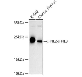 Western Blot - Anti-IL-28B Antibody (A307915) - Antibodies.com