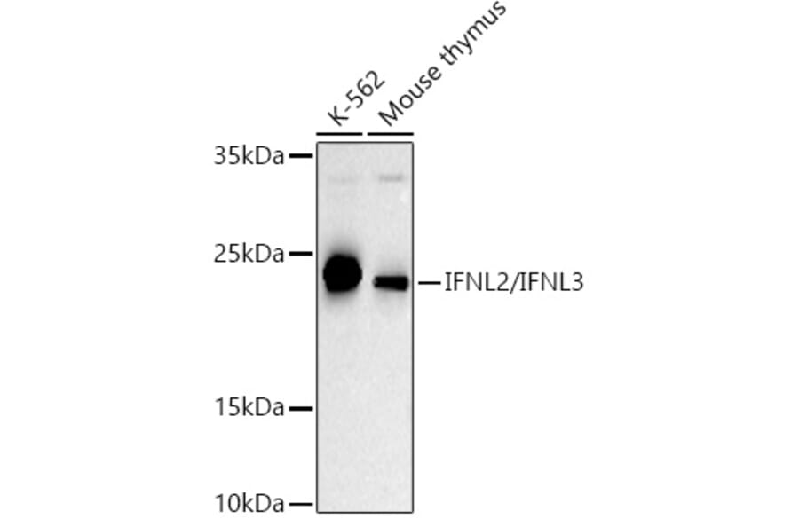 Western Blot - Anti-IL-28B Antibody (A307915) - Antibodies.com