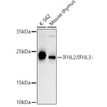 Western Blot - Anti-IL-28B Antibody (A307915) - Antibodies.com