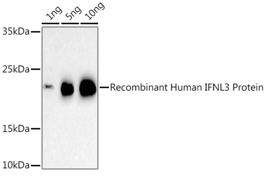 Western Blot - Anti-IL-28B Antibody (A307915) - Antibodies.com