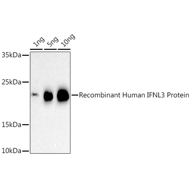 Western Blot - Anti-IL-28B Antibody (A307915) - Antibodies.com