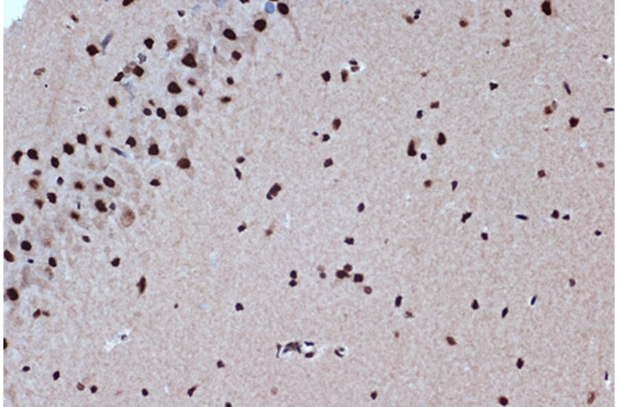 Immunohistochemistry - Anti-Bub3 Antibody [ARC1318] (A307916) - Antibodies.com