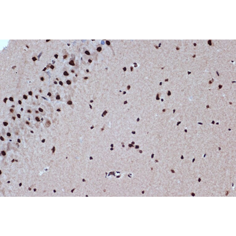 Immunohistochemistry - Anti-Bub3 Antibody [ARC1318] (A307916) - Antibodies.com