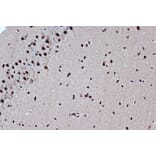 Immunohistochemistry - Anti-Bub3 Antibody [ARC1318] (A307916) - Antibodies.com
