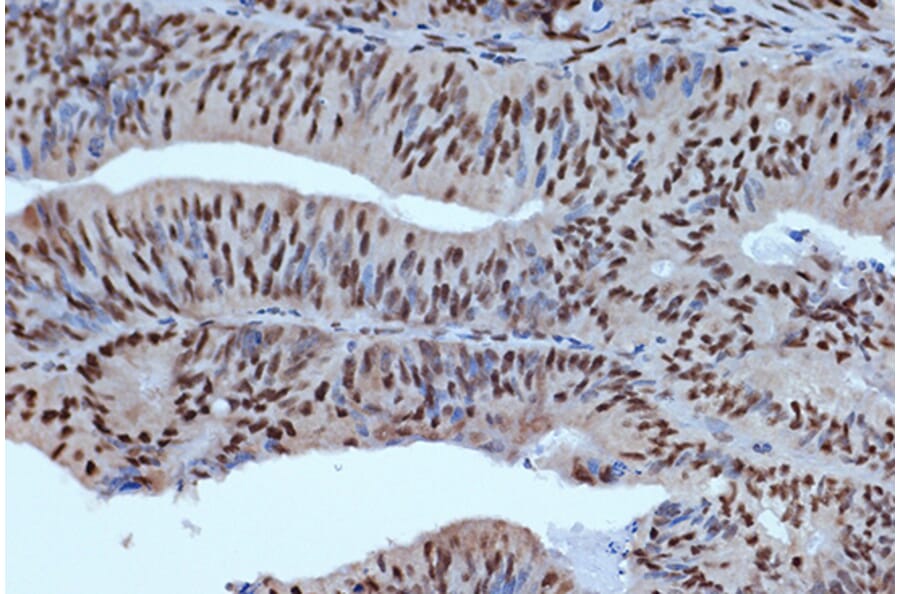 Immunohistochemistry - Anti-Bub3 Antibody [ARC1318] (A307916) - Antibodies.com