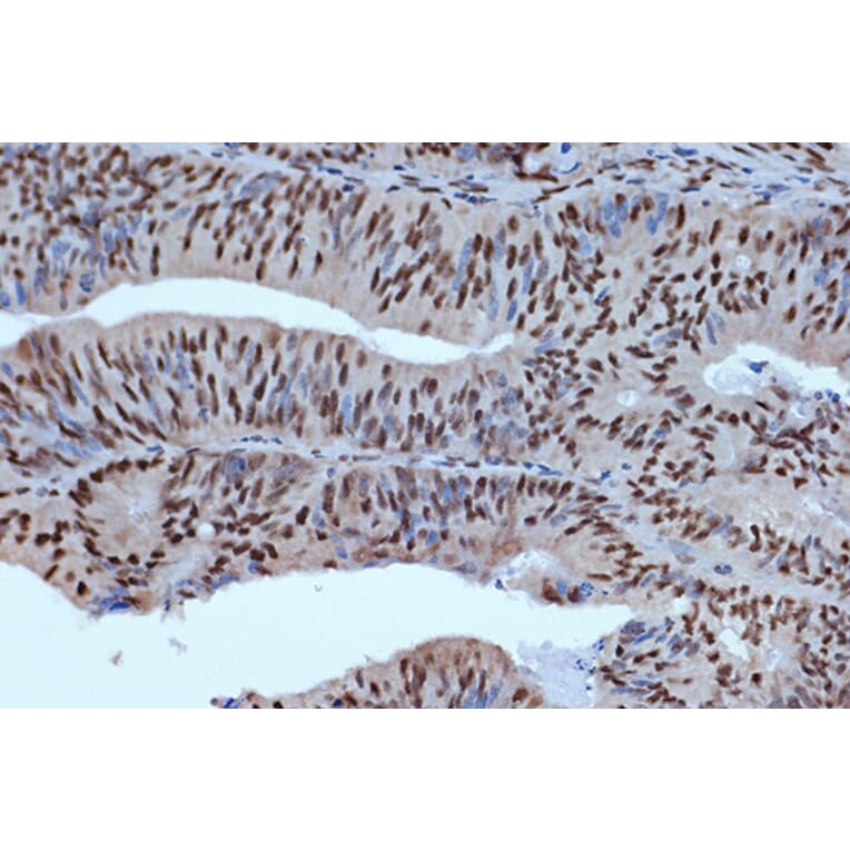 Immunohistochemistry - Anti-Bub3 Antibody [ARC1318] (A307916) - Antibodies.com