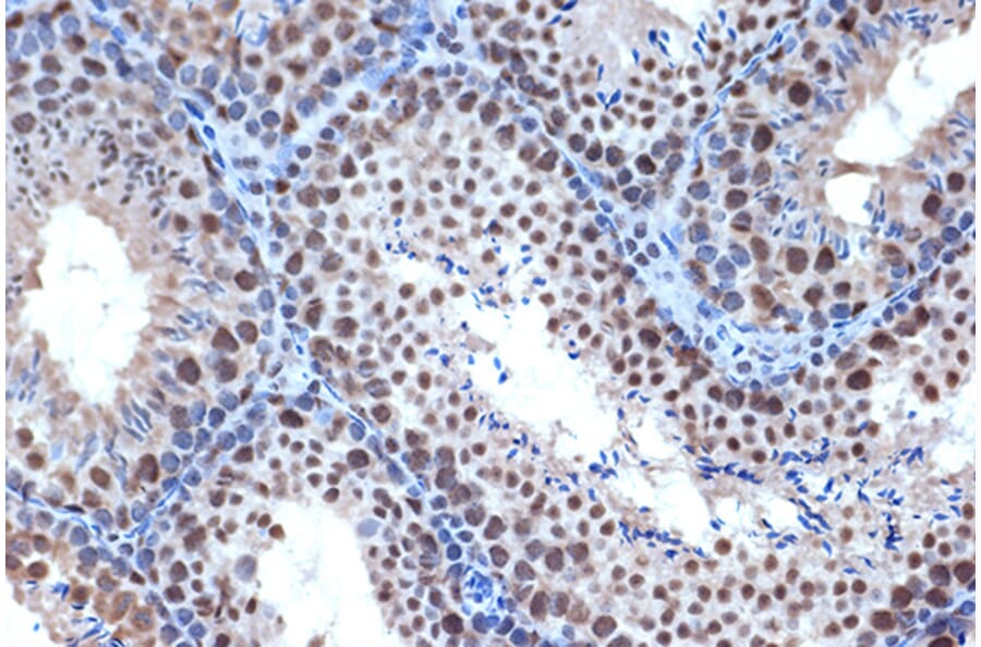 Immunohistochemistry - Anti-Bub3 Antibody [ARC1318] (A307916) - Antibodies.com