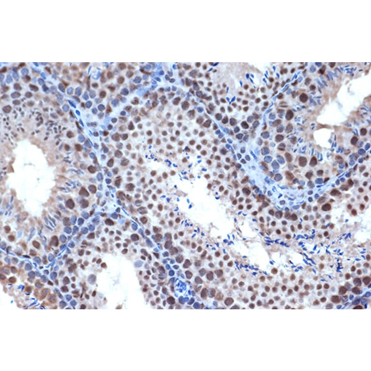 Immunohistochemistry - Anti-Bub3 Antibody [ARC1318] (A307916) - Antibodies.com