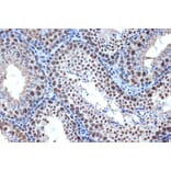 Immunohistochemistry - Anti-Bub3 Antibody [ARC1318] (A307916) - Antibodies.com