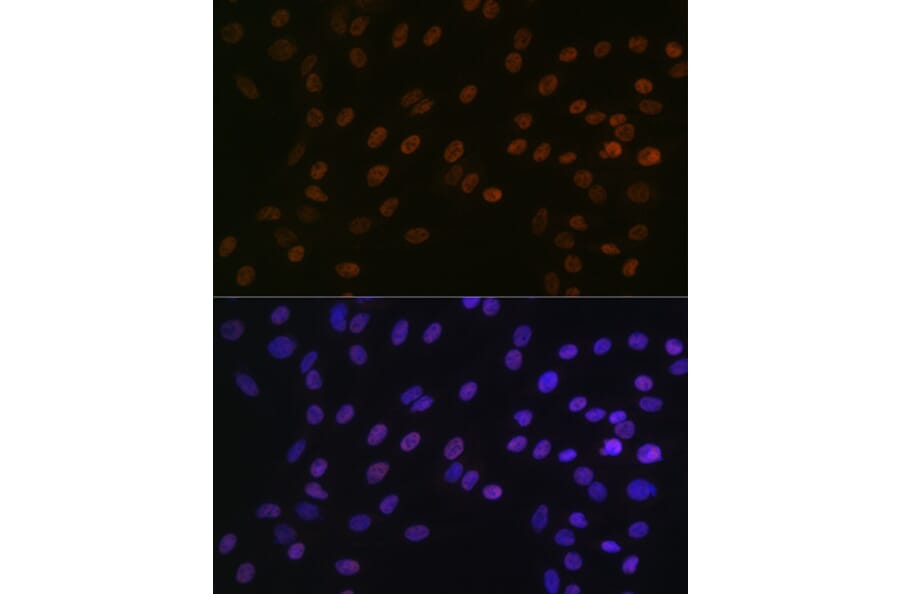 Immunofluorescence - Anti-Bub3 Antibody [ARC1318] (A307916) - Antibodies.com
