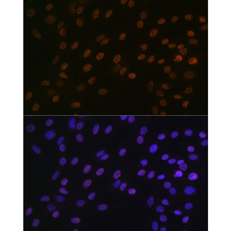 Immunofluorescence - Anti-Bub3 Antibody [ARC1318] (A307916) - Antibodies.com