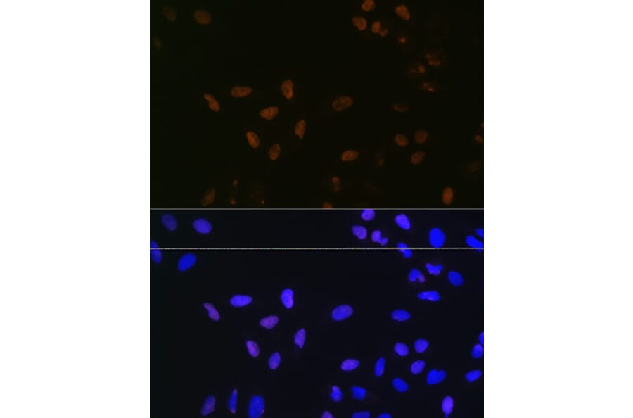 Immunofluorescence - Anti-Bub3 Antibody [ARC1318] (A307916) - Antibodies.com