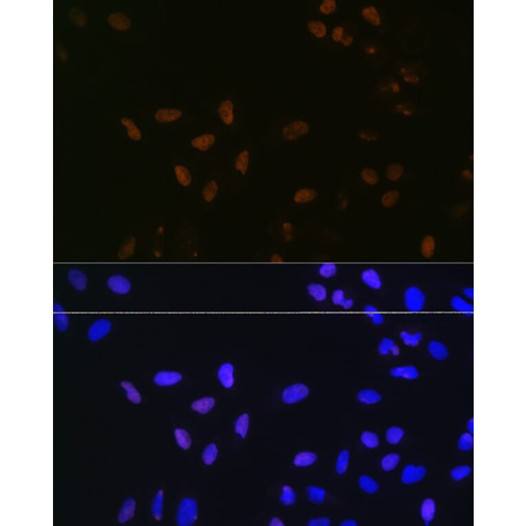 Immunofluorescence - Anti-Bub3 Antibody [ARC1318] (A307916) - Antibodies.com
