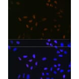 Immunofluorescence - Anti-Bub3 Antibody [ARC1318] (A307916) - Antibodies.com