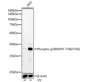 Western Blot - Anti-p38 MAPK (phospho Thr180 + Tyr182) Antibody [ARC51018] (A307918) - Antibodies.com