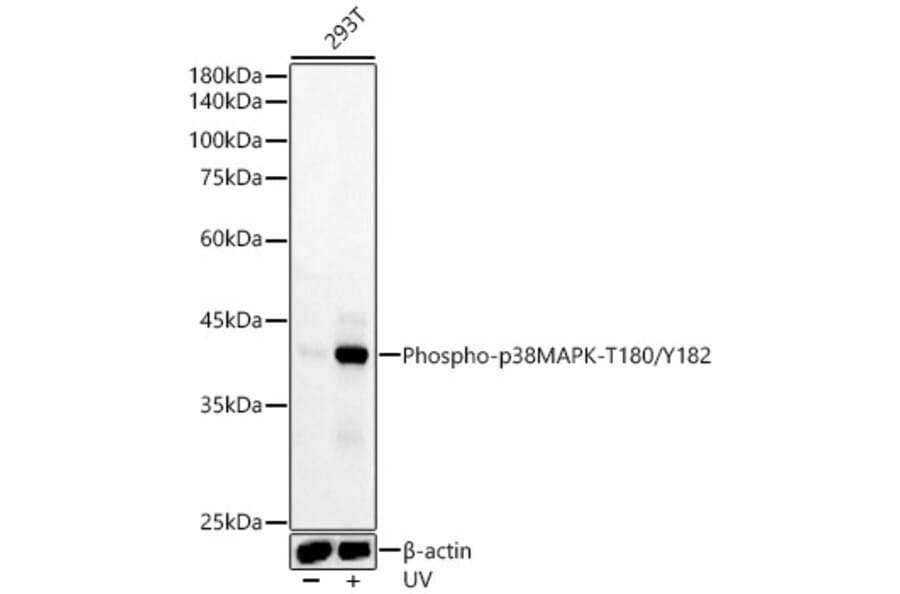 Western Blot - Anti-p38 MAPK (phospho Thr180 + Tyr182) Antibody [ARC51018] (A307918) - Antibodies.com