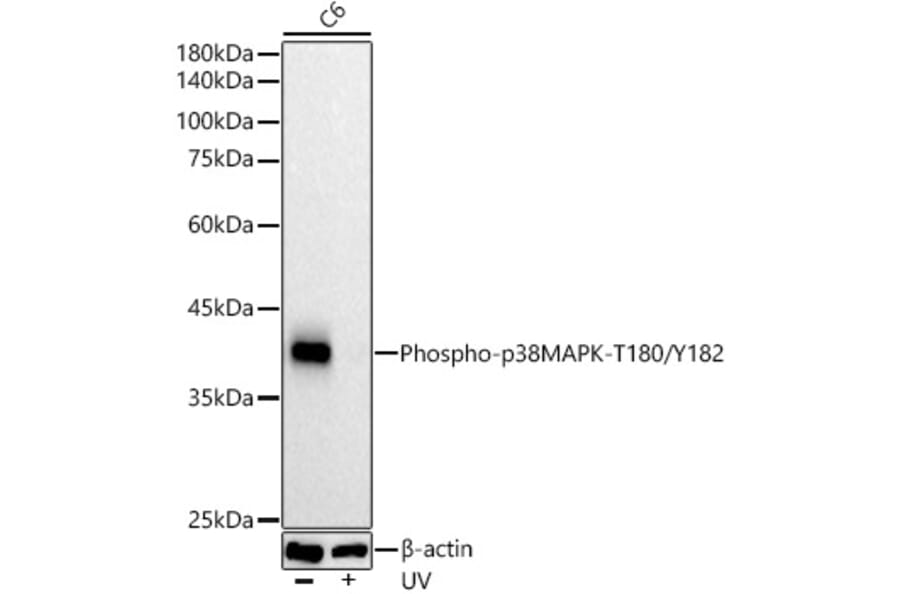 Western Blot - Anti-p38 MAPK (phospho Thr180 + Tyr182) Antibody [ARC51018] (A307918) - Antibodies.com