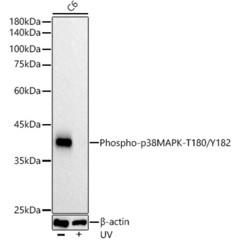 Western Blot - Anti-p38 MAPK (phospho Thr180 + Tyr182) Antibody [ARC51018] (A307918) - Antibodies.com