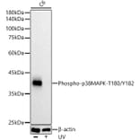 Western Blot - Anti-p38 MAPK (phospho Thr180 + Tyr182) Antibody [ARC51018] (A307918) - Antibodies.com