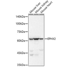 Western Blot - Anti-EPHX2 Antibody [ARC2895] (A307925) - Antibodies.com