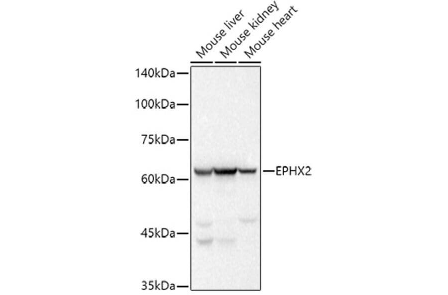 Western Blot - Anti-EPHX2 Antibody [ARC2895] (A307925) - Antibodies.com