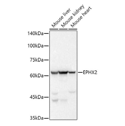 Western Blot - Anti-EPHX2 Antibody [ARC2895] (A307925) - Antibodies.com