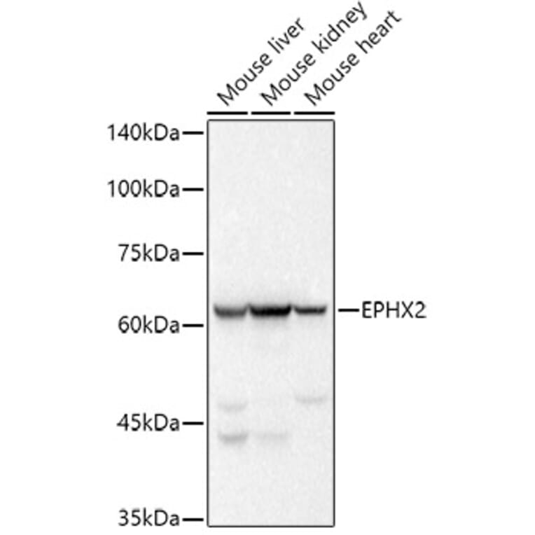 Western Blot - Anti-EPHX2 Antibody [ARC2895] (A307925) - Antibodies.com