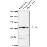 Western Blot - Anti-EPHX2 Antibody [ARC2895] (A307925) - Antibodies.com